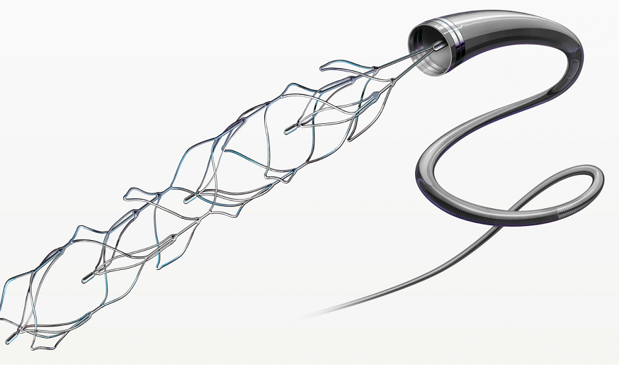 Stent Retrievers