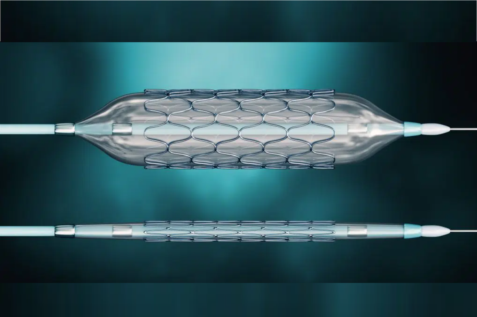 Stents