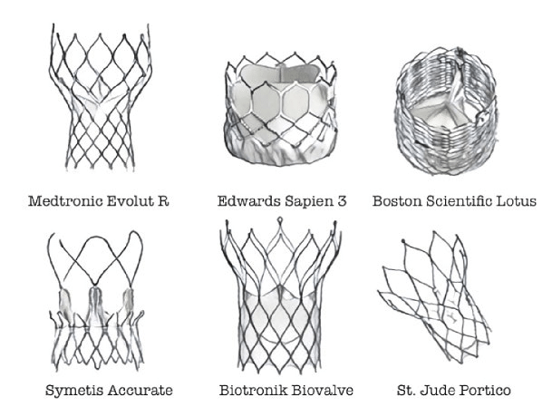 Valvular Devices